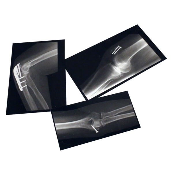 Fixed Bones X-Ray Set